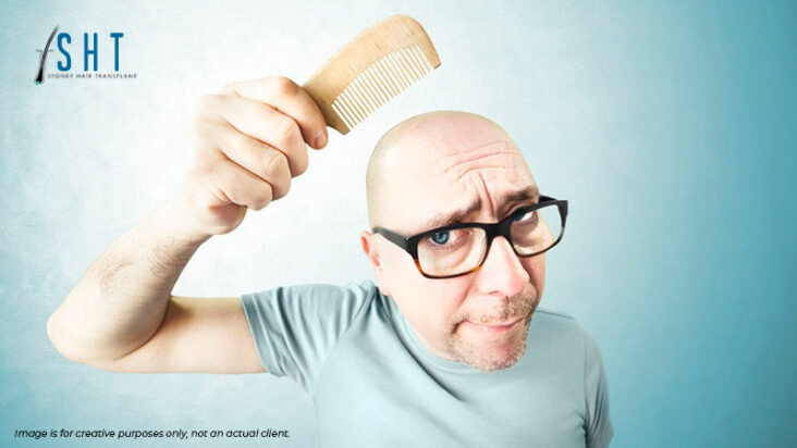 What To Do When Hairs Start Falling A Guide On Hair Loss